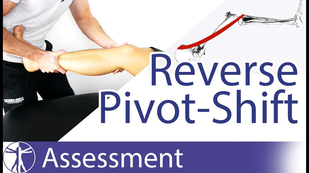 Reverse Pivot-Shift Test | Posterolateral Rotatory Instability of the Knee