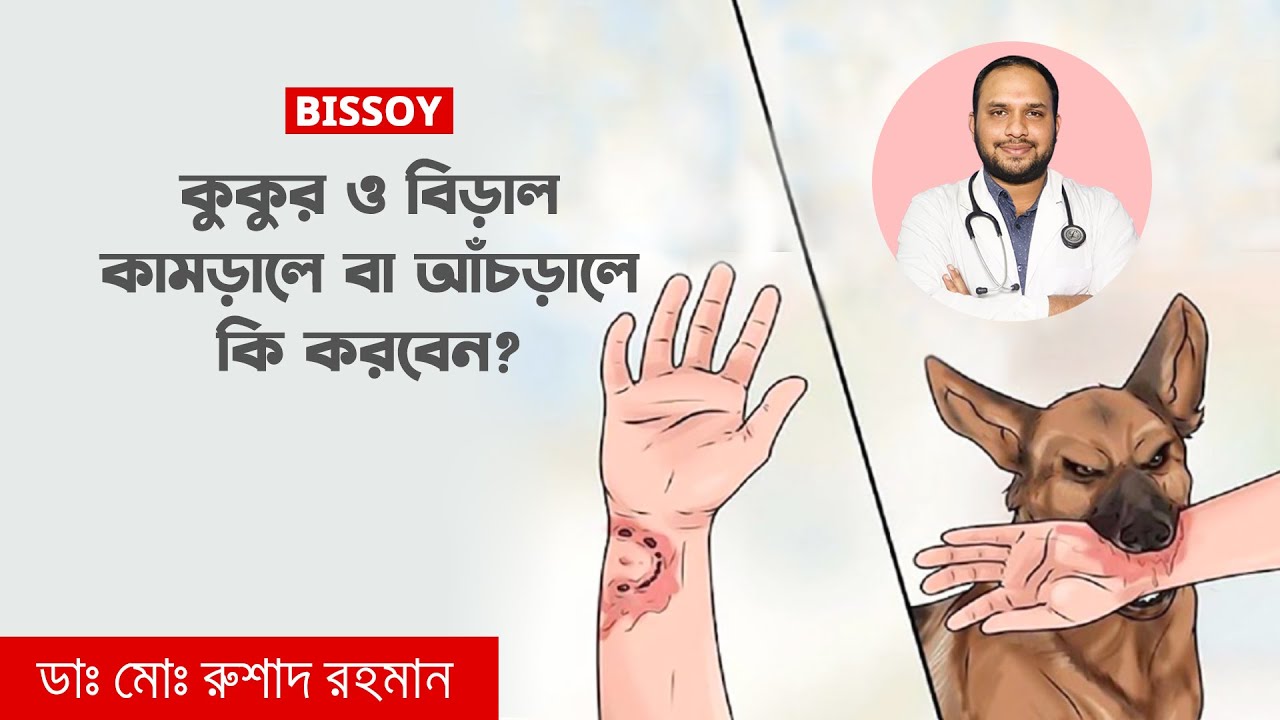 কুকুর ও বিড়াল কামড়ালে বা আঁচড় দিলে কি করবেন? কয়টা ভ্যাকসিন দিতে হবে? কতদিন পর দিতে হবে?