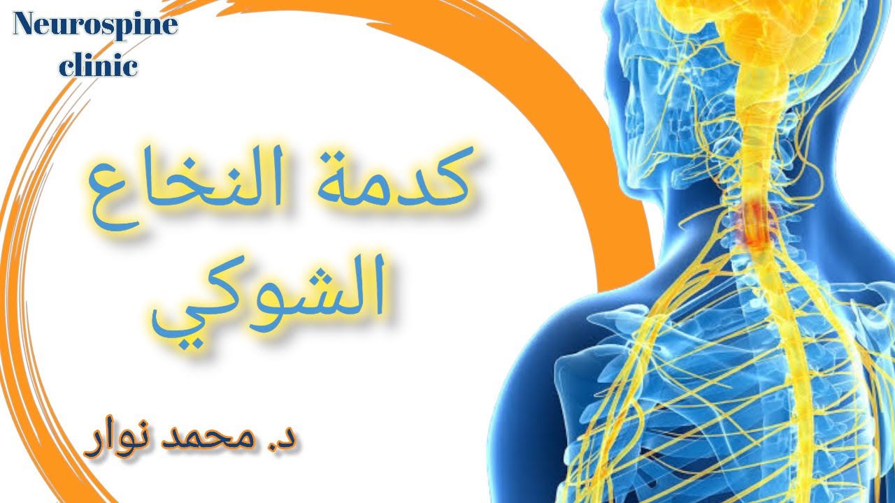 كدمات النخاع الشوكي