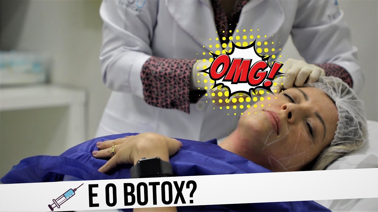 INJETEI COLÁGENO, (SCULPTRA) VEJA NO QUE DEU! - Juliana Bacellar