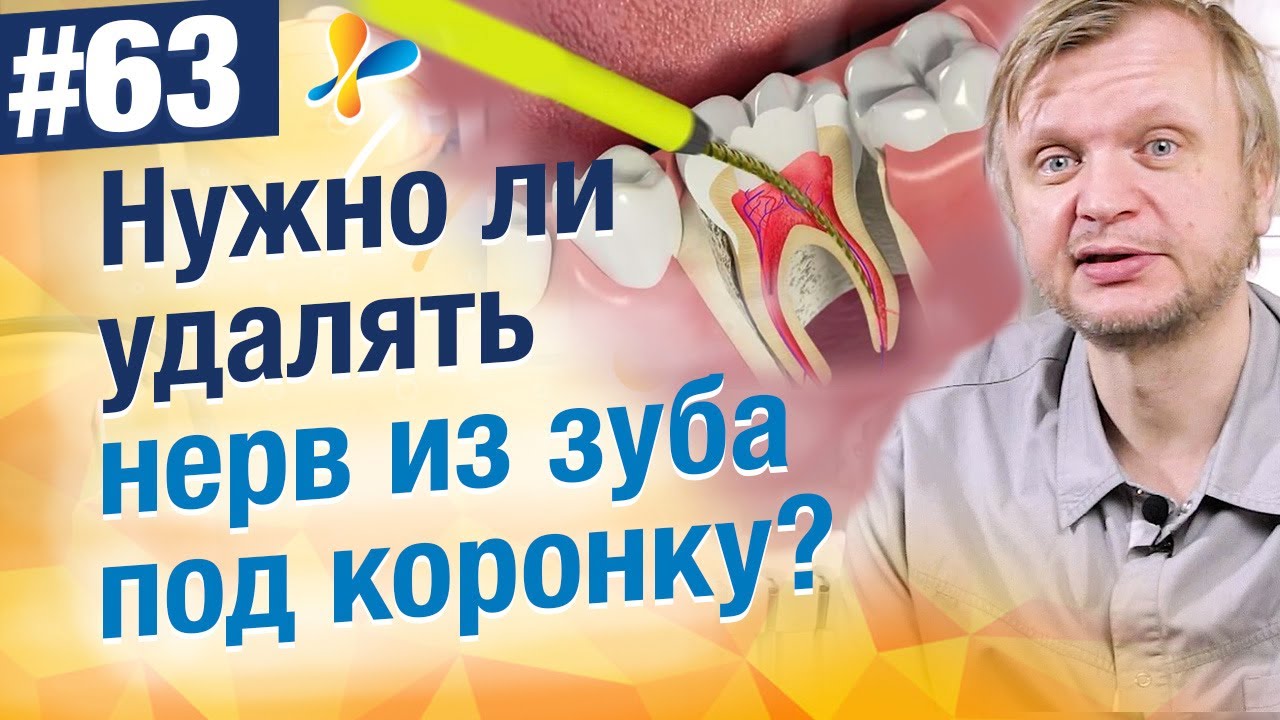 Всегда ли удаляют нерв из зуба под коронку