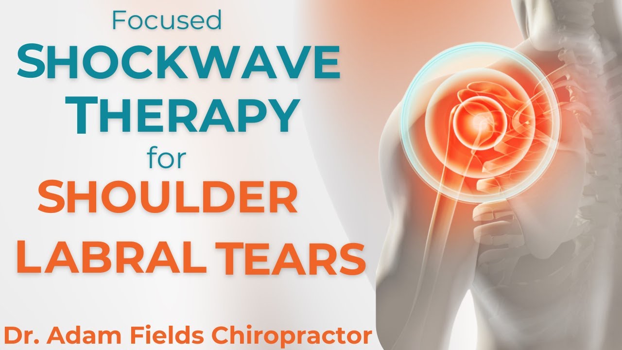 Shockwave Therapy & Shoulder Labral Tears | ESWT for Rotator Cuff Instability