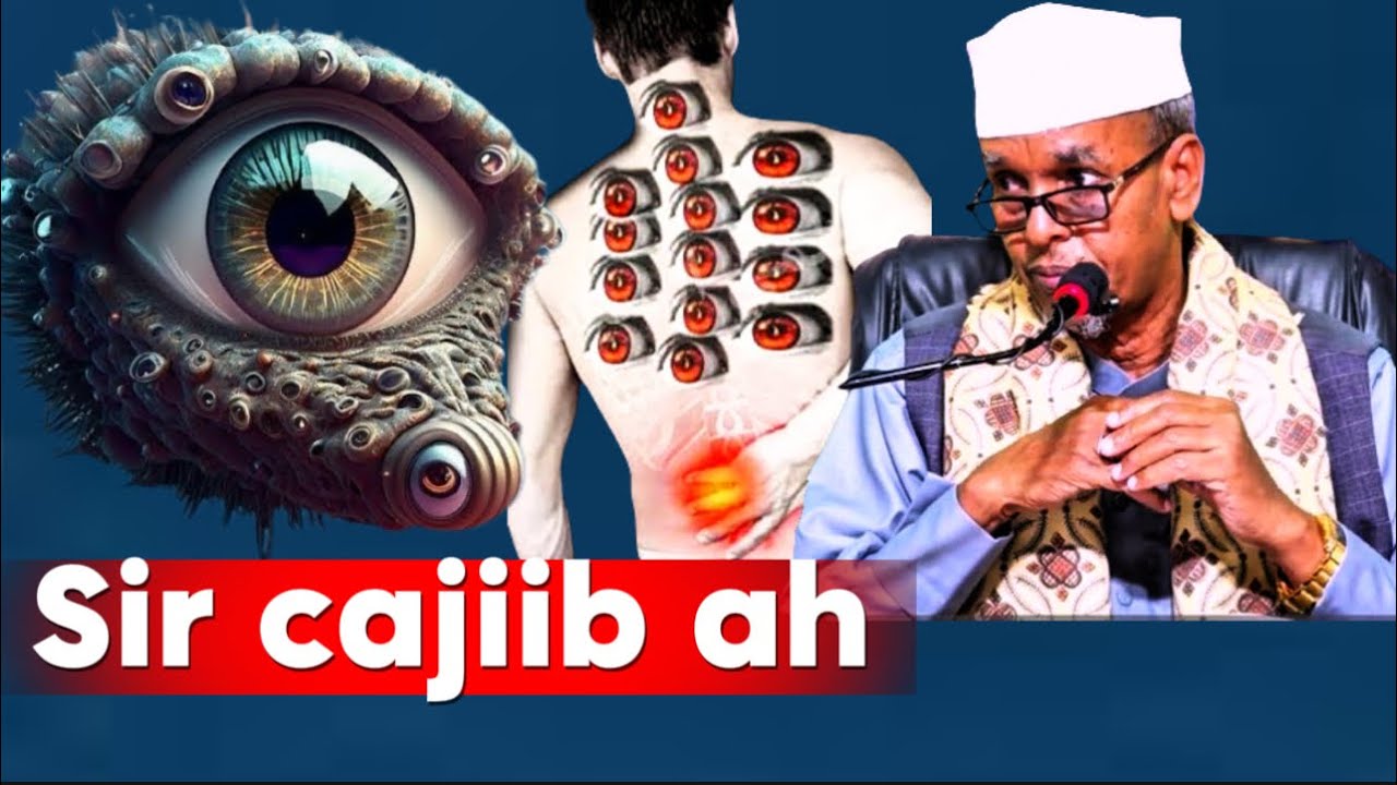 Xog Sir ah: Sidee Lagu Gartaa Qofka Ku Xasadey? Calaamadaha xasadka– Sheekh Maxamed