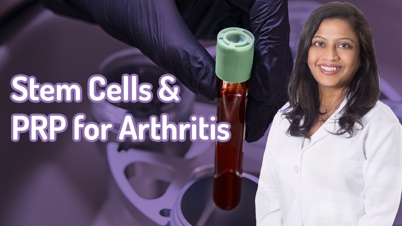 Stem Cells and PRP for Arthritis | A Short Guide to Everything You Need to Know by Dr Humeira Badsha