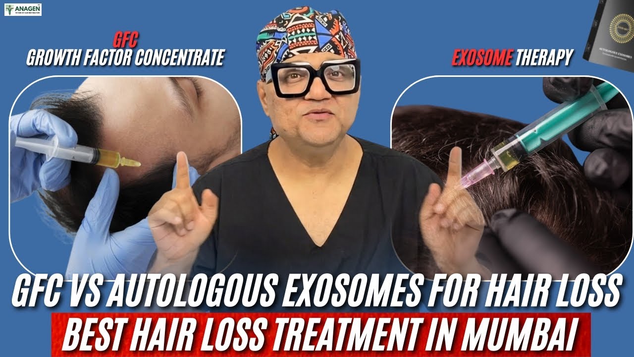 GFC vs Autologous Exosomes for Hair Loss | Best Hair Loss Treatment in Mumbai