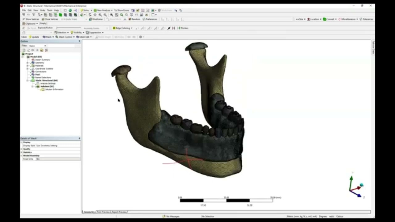 Finite Element Analysis in Orthodontics