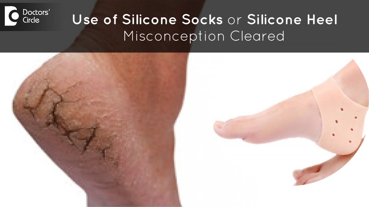 Use of silicone socks or silicone heel for treating cracked heels - Dr.Nischal K C | Doctors' Circle