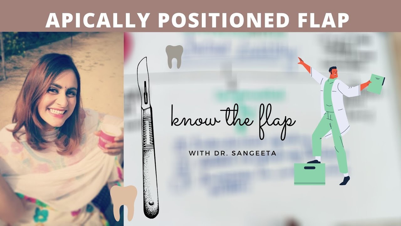 apically positioned flap periodontal surgery