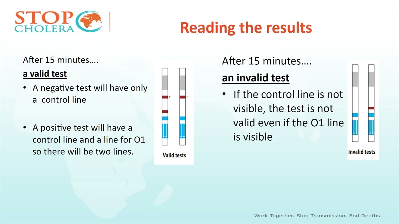 Instructions for using Rapid Diagnostic Test