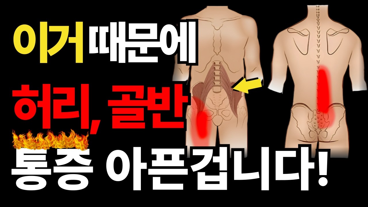 병원 망할 각오로 알려드리는 허리,골반 통증 없애주는 장요근 초간단 자가치료법