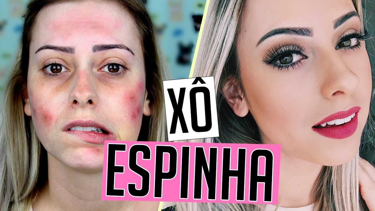 COBRINDO ESPINHAS E MANCHAS COM MAQUIAGEM | Amanda Domenico