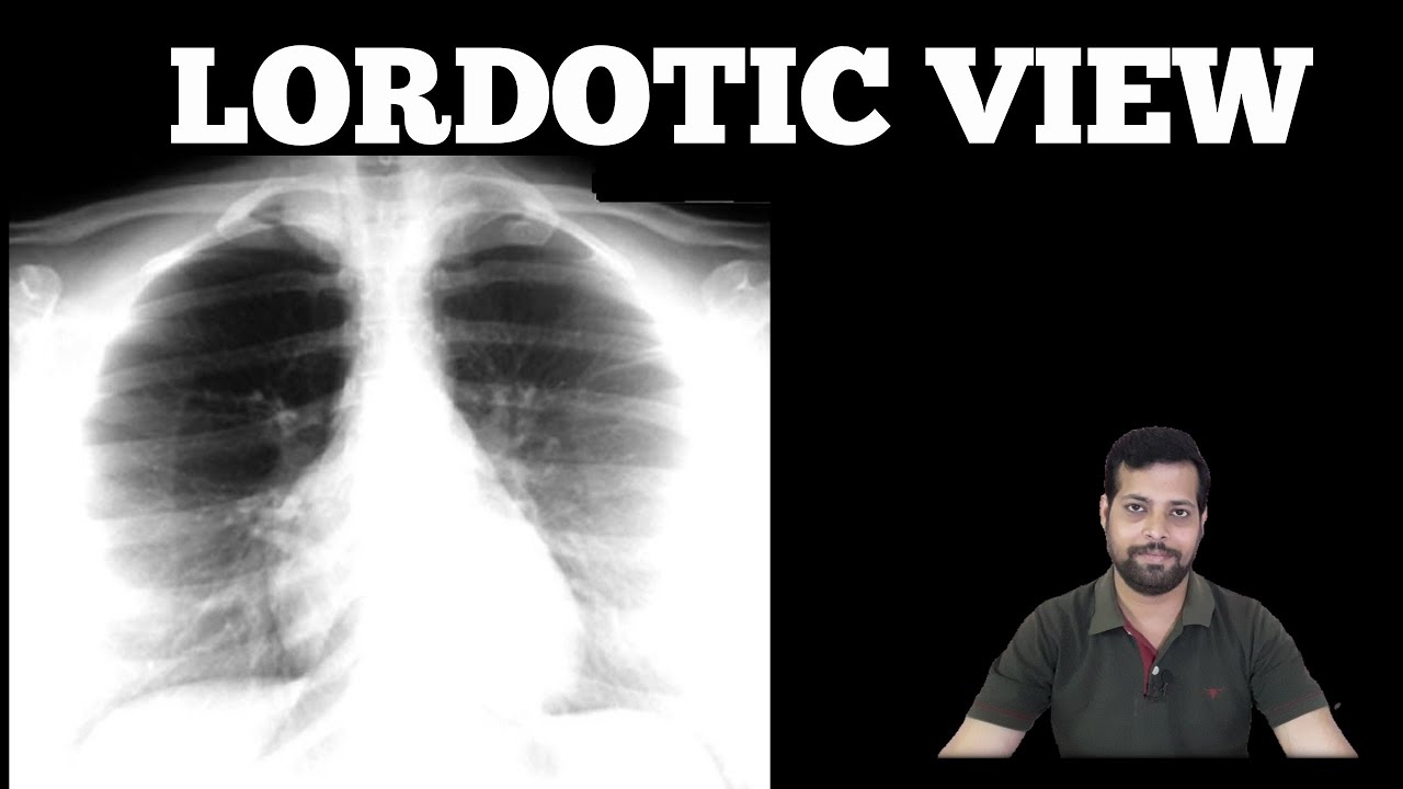 LORDOTIC VIEW//  APICOGRAM VIEW #xrayclasses #debmeet
