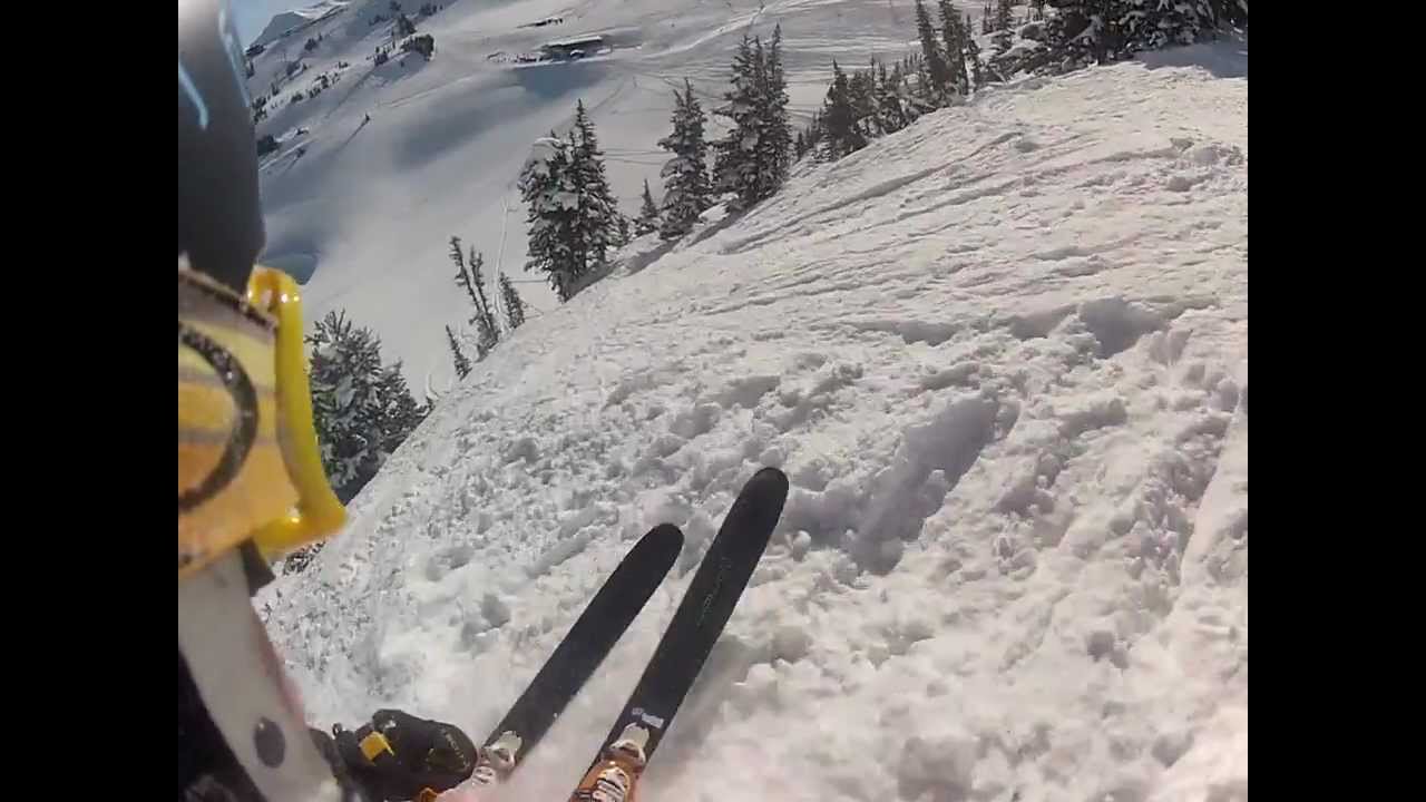 Air Jordan Skills or Hospital Bills?