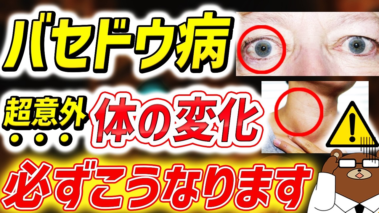 汗・食欲・動悸..知らないと必ず損する「バセドウ病」の意外な初期症状。甲状腺の機能はなぜ暴走するのか。眼球が飛び出る？更年期と間違える？予防法はあるのか。医師が完全解説。