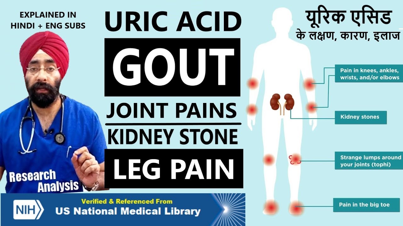 Why do you have HIGH URIC ACID Problem | GOUT | KIDNEY STONE | JOINT PAIN | Dr.Education (Hin + Eng)