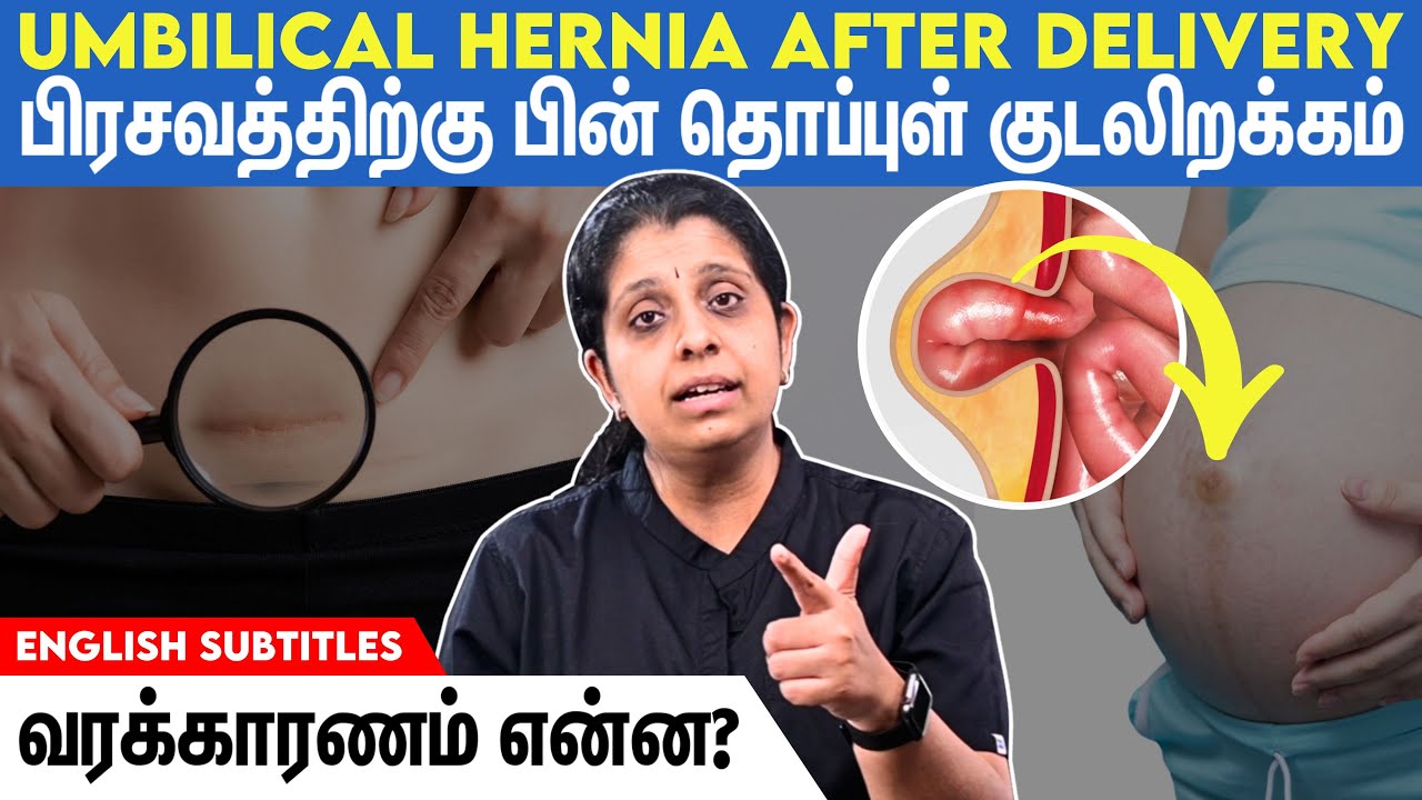 Umbilical hernia after childbirth | பிரசவத்திற்குப் பின் தொப்புள் குடலிறக்கம் ஏன் வருகிறது?