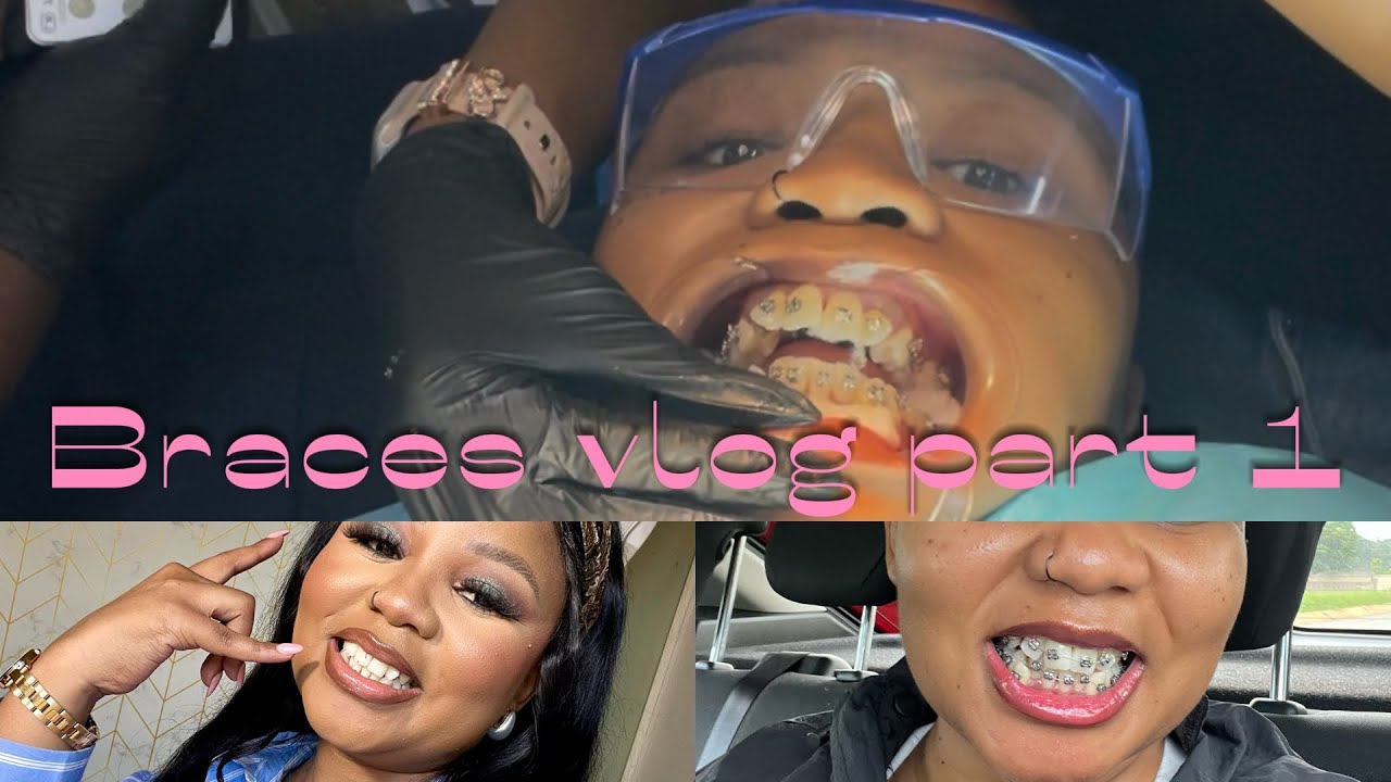 Vloggy Vlog: Lets go get Braces | Adult braces journey Part 1| #roadto1k #sayoutuber #keamaggz