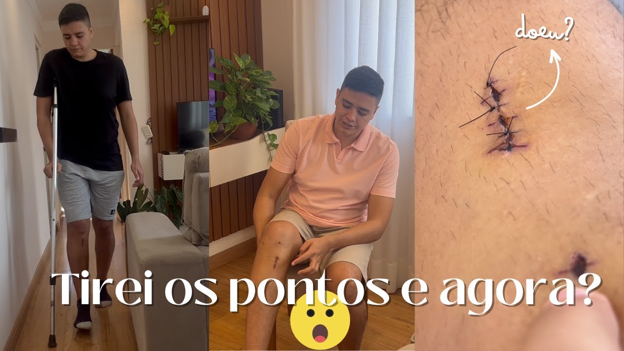 DICAS: PRÉ E PÓS-OPERATÓRIO | EXERCÍCIOS APÓS 2 SEMANAS DE CIRURGIA LCA 🦵🏽| COMO ESTÁ MINHA PASSADA?