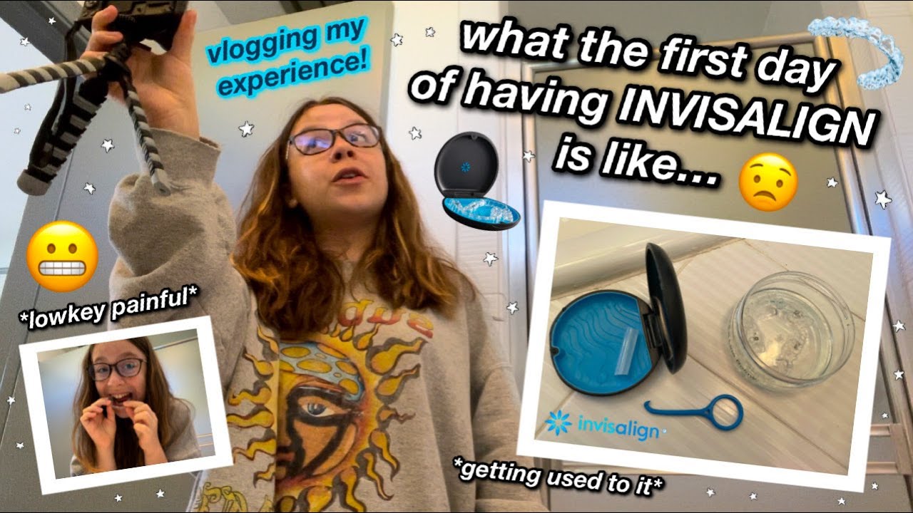 what the first day of having INVISALIGN is like!! // vlog