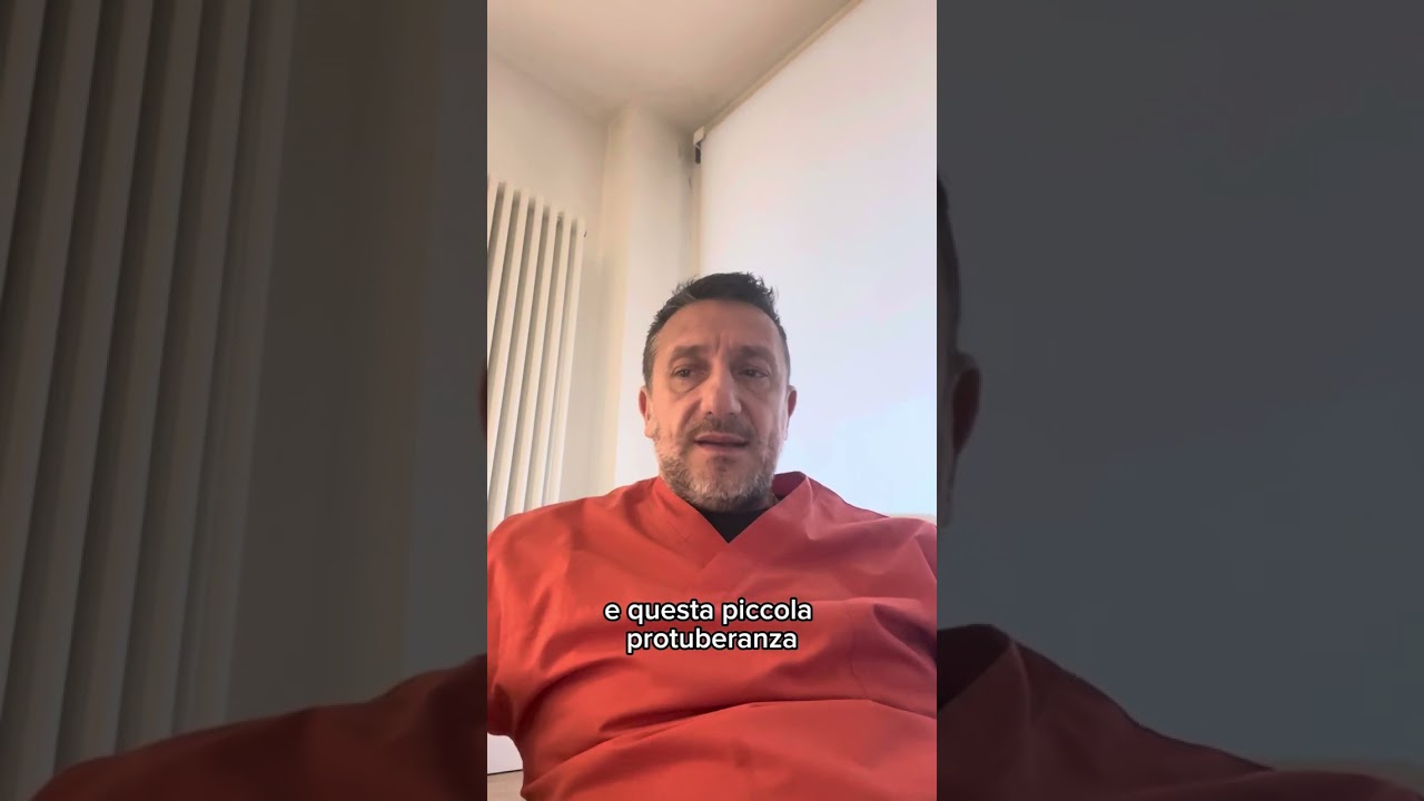 Cos'&egrave; la gobba del bisonte ?