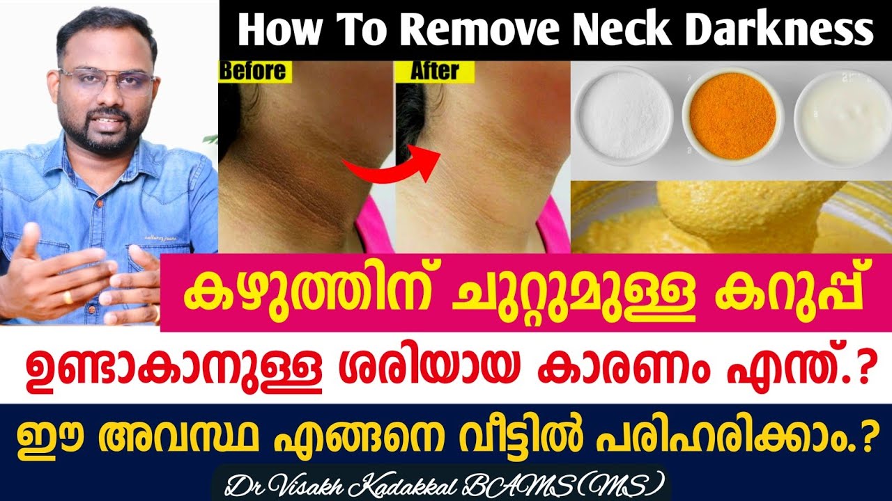 കഴുത്തിന് ചുറ്റുമുള്ള കറുപ്പ് വീട്ടിൽ ഈസിയായി പരിഹരിക്കാം | ഇങ്ങനെ ഉണ്ടാകാനുള്ള  കാരണങ്ങൾ അറിയാം