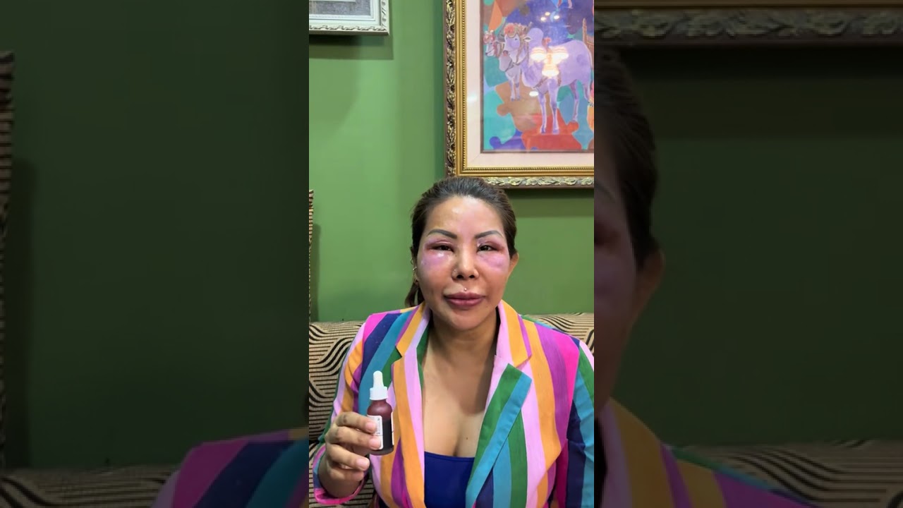 ဇာလို ဘယ်သူမှာ မဖြစ်ရလေးအောင် ပြောပြခြင်း