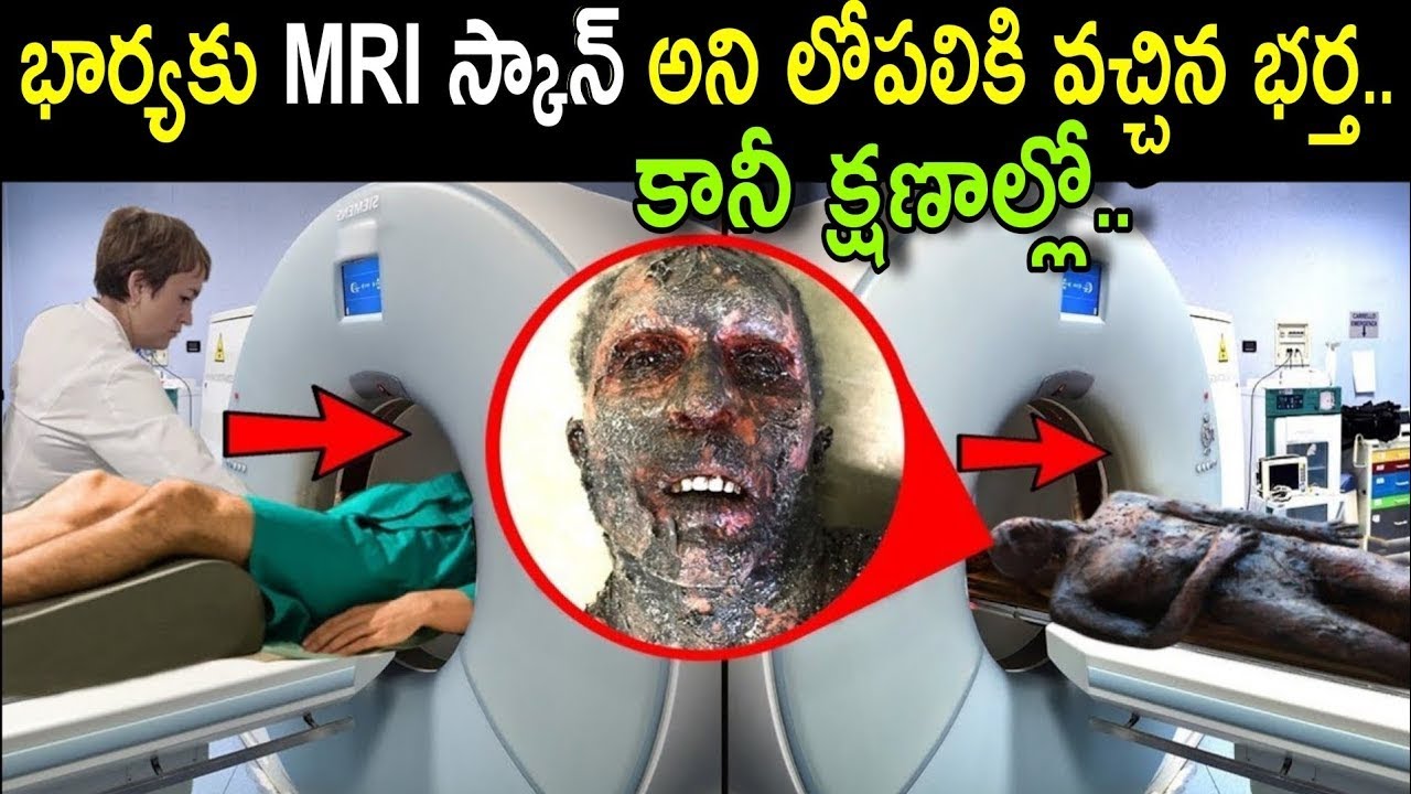 భర్త తన భార్యకు MRI స్కాన్ అని లోపలికి వచ్చాడు. కానీ క్షణాల్లో MRI చేయించుకునే ముందు @telugufactor