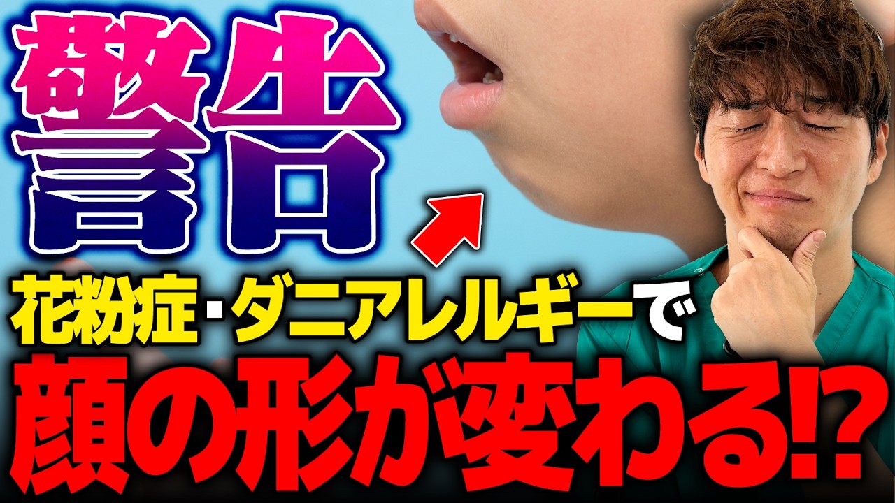 【アデノイド顔貌】花粉症・ダニアレルギーで子供の顔が変わります。
