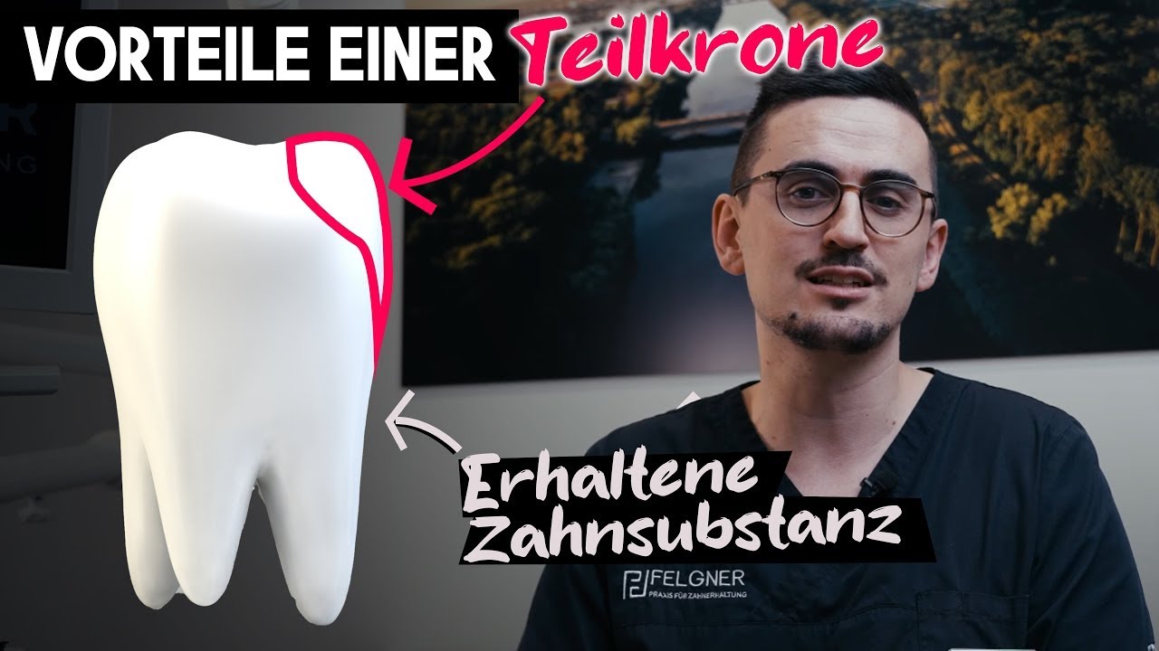 Zahn erhalten statt Wegschleifen. Warum Teilkronen so viele Vorteile bieten.