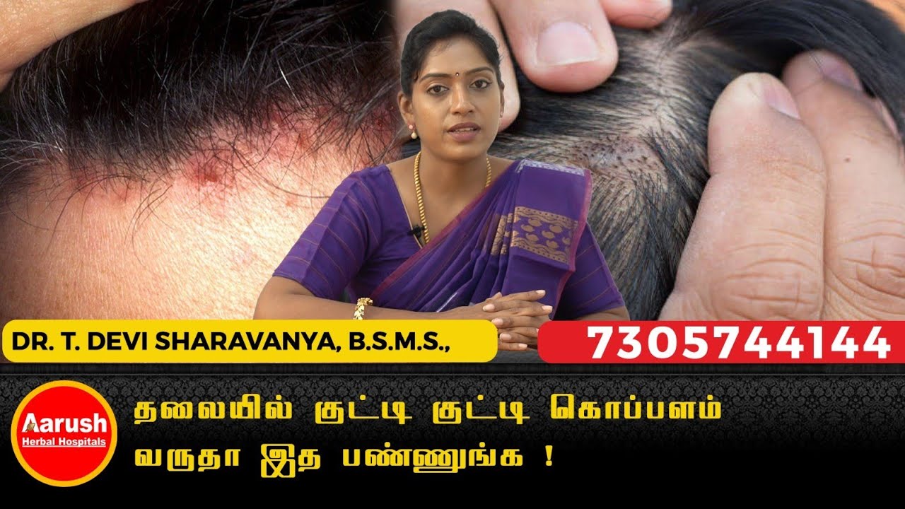 தலையில் குட்டி குட்டி கொப்பளம் வருதா இத பண்ணுங்க ! | Siddha Dr.T.Devi Sharavanya | Aarush Herbal