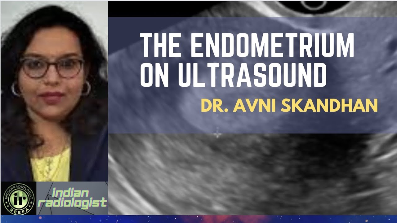The Endometrium on Ultrasound || Dr Avni Skandhan || Beginner Tips || Endometrial changes