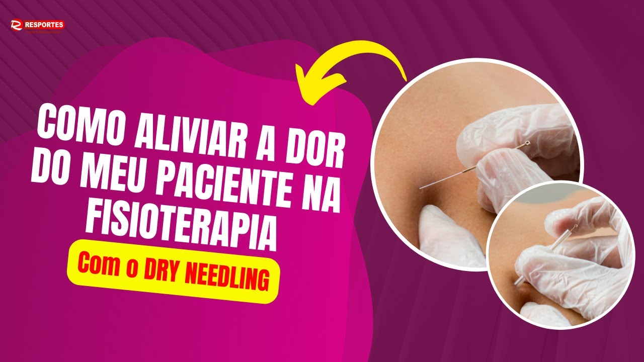 A maneira correta de APLICAR O DRY NEEDLING para ALIVIO DA DOR!