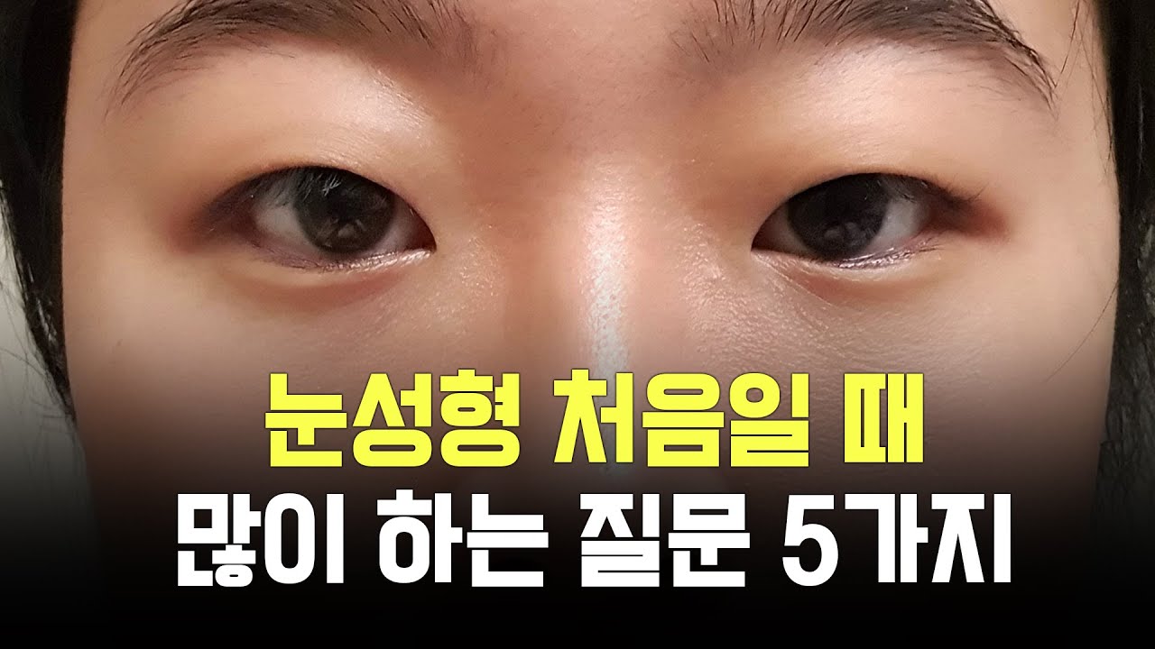 비슷한 눈의 구조 가지신 분들은 공감하실 거예요.