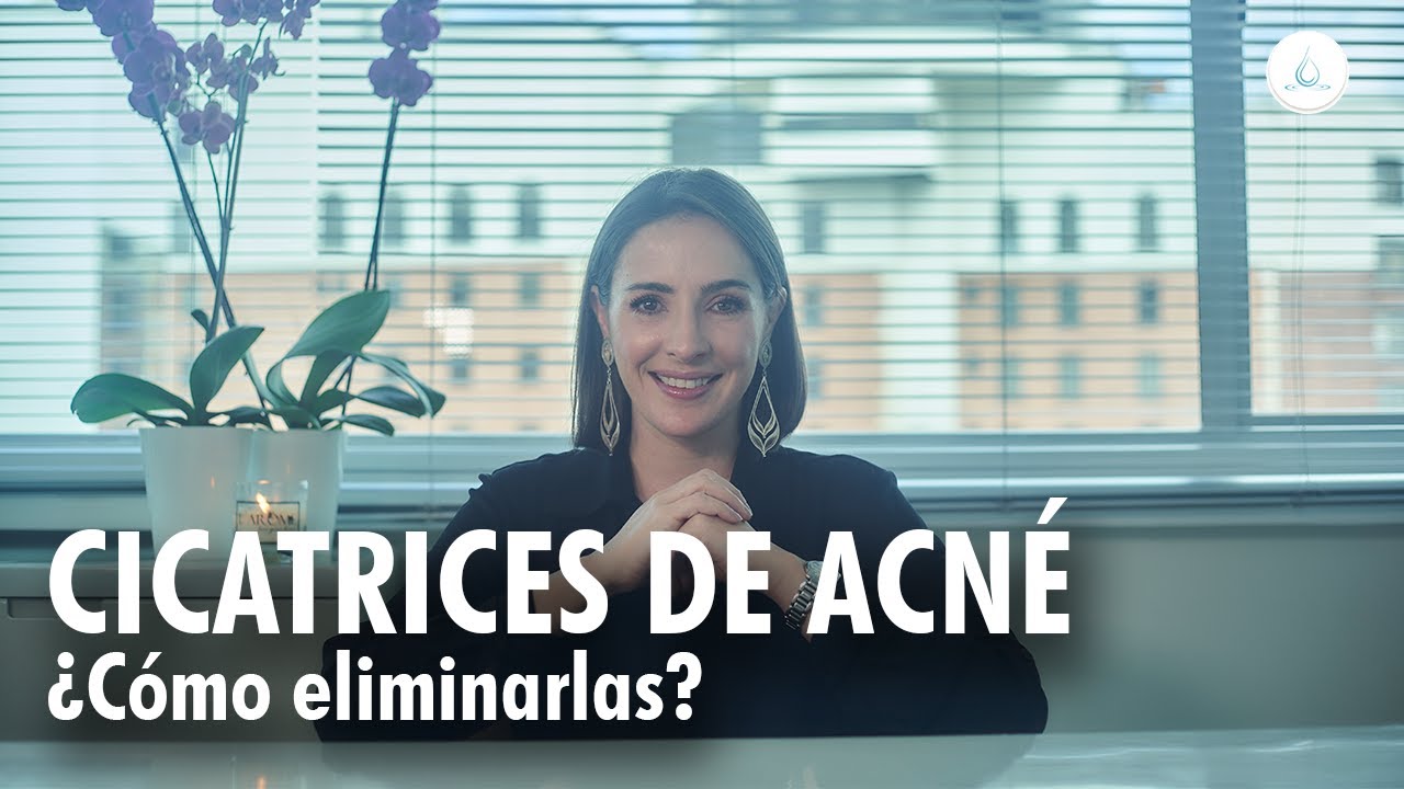 🔴 CICATRICES de ACNE &iquest;Como TRATARLAS? @drapilarochoa  - Dermatologa