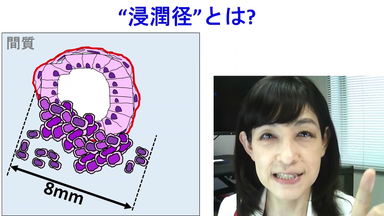 腫瘍径と浸潤径は違う。【あなたの乳がんは何センチ?】