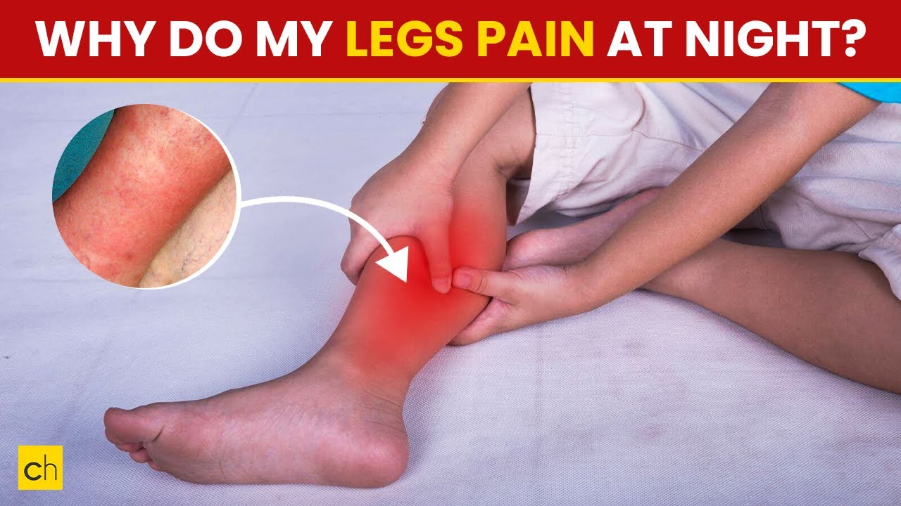 Why Do My Legs Ache At Night - Shocking Reasons Must Know