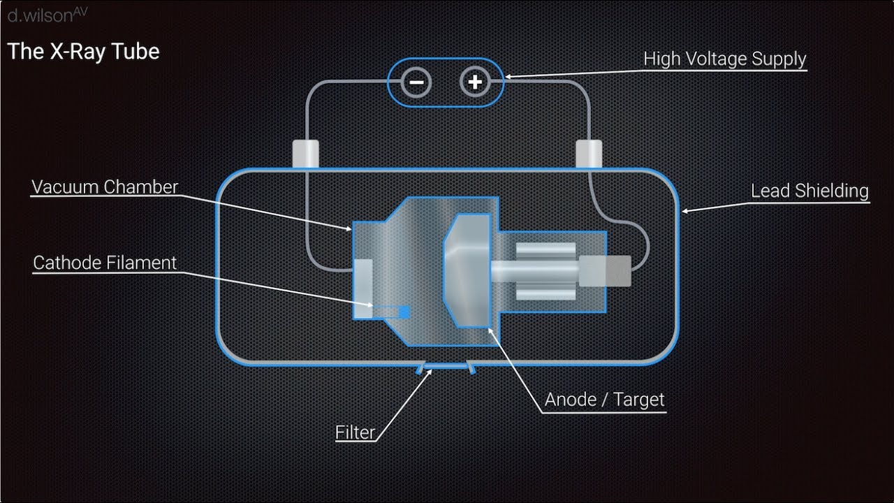 X Ray Production Animation