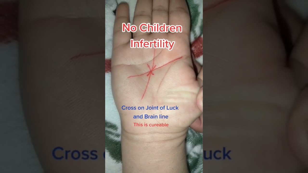 Infertility but Cureable #palmistry #palmreadings #fortuner #kids #children #cure #life #cross