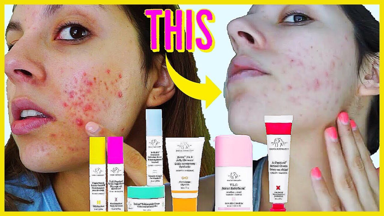 DRUNK ELEPHANT SAVED MY SKIN?! Drunk Elephant Skincare for Acne