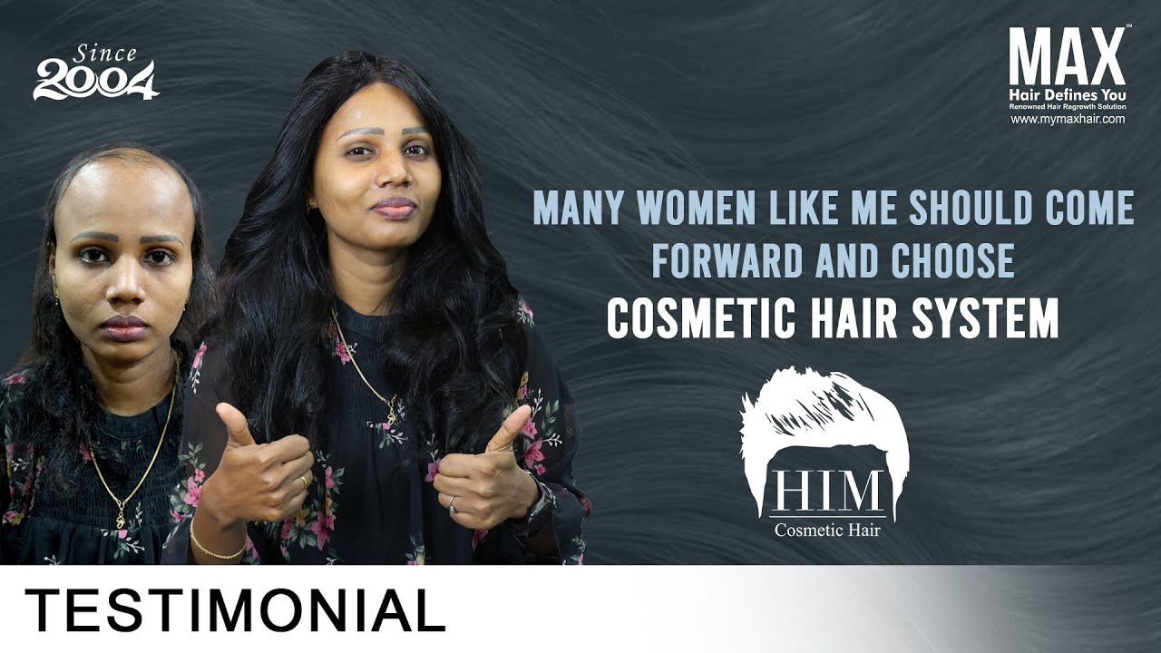 This Woman is the Face of Change |Life-Changing Choice : Cosmetic Hair System at MAX Hair Clinic