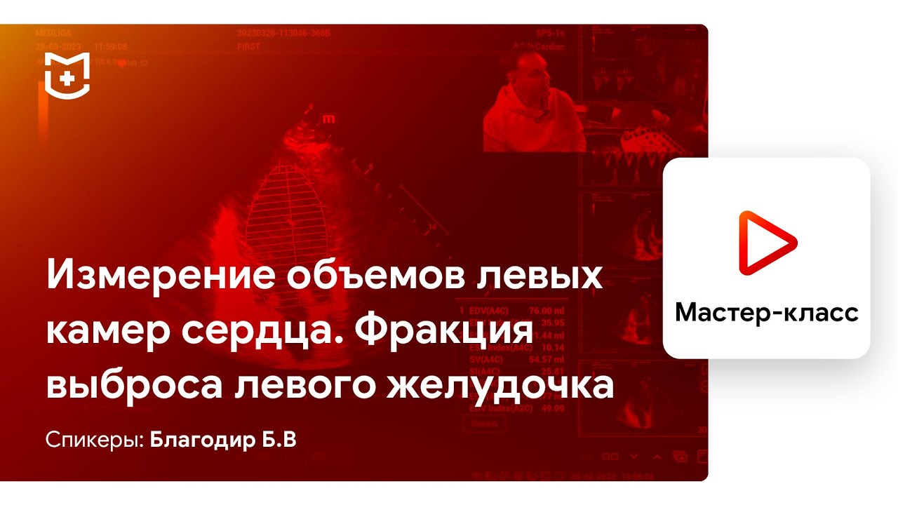 Измерение и расчеты в ЭхоКГ. Измерение объемов левых камер сердца. Благодир Б.В.