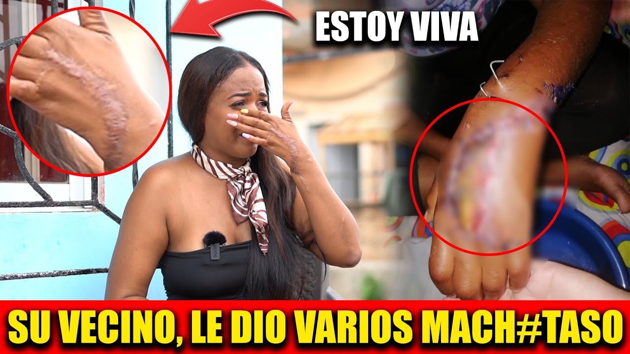 UN VECINO LE DIO VARIOS MACH3TASO, ELLA SOBREVIVIO DE MILAGRO 😲😱