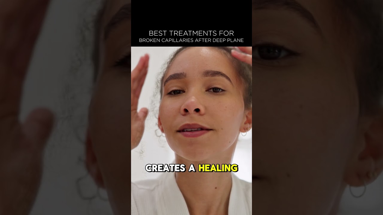 How to Treat Broken Capillaries After a Deep Plane Facelift