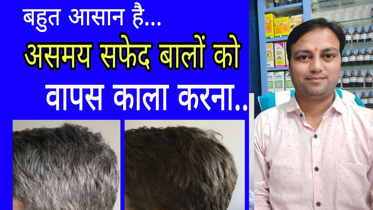असमय सफेद बालों का आसान इलाज, Premature graying of hair treatment in hindi, how to reverse gray hair