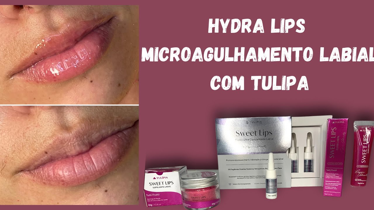 Hydra Lips com Produtos Tulipa