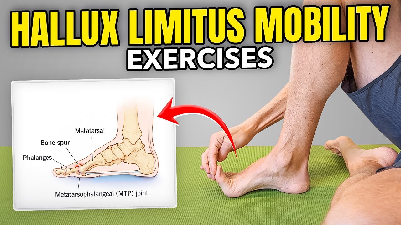 Упражнения на подвижность большого пальца ноги (Hallux Limitus)