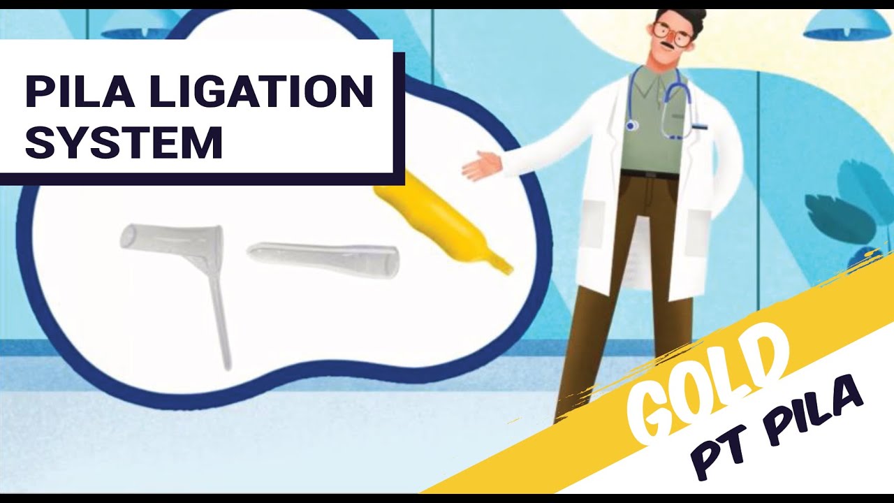 PT PILA - Pila Ligation System