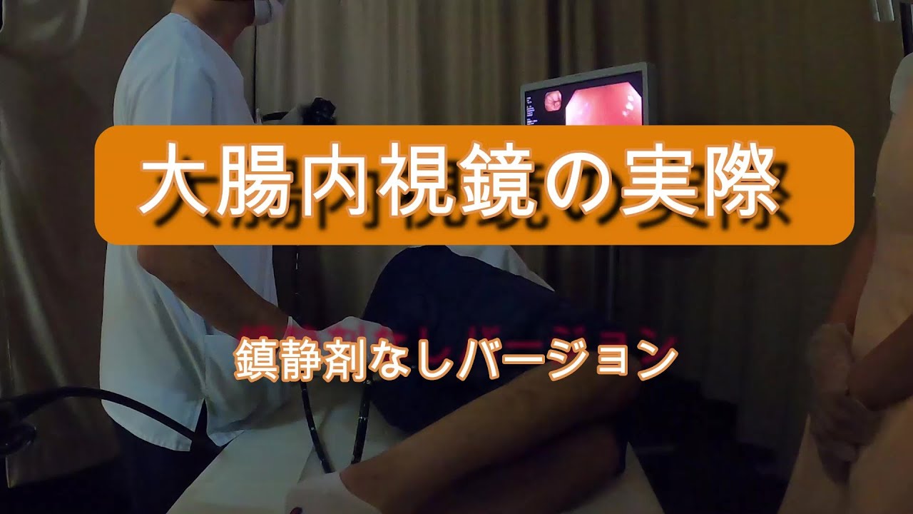 大腸内視鏡(鎮静剤なしバージョン）50代男性