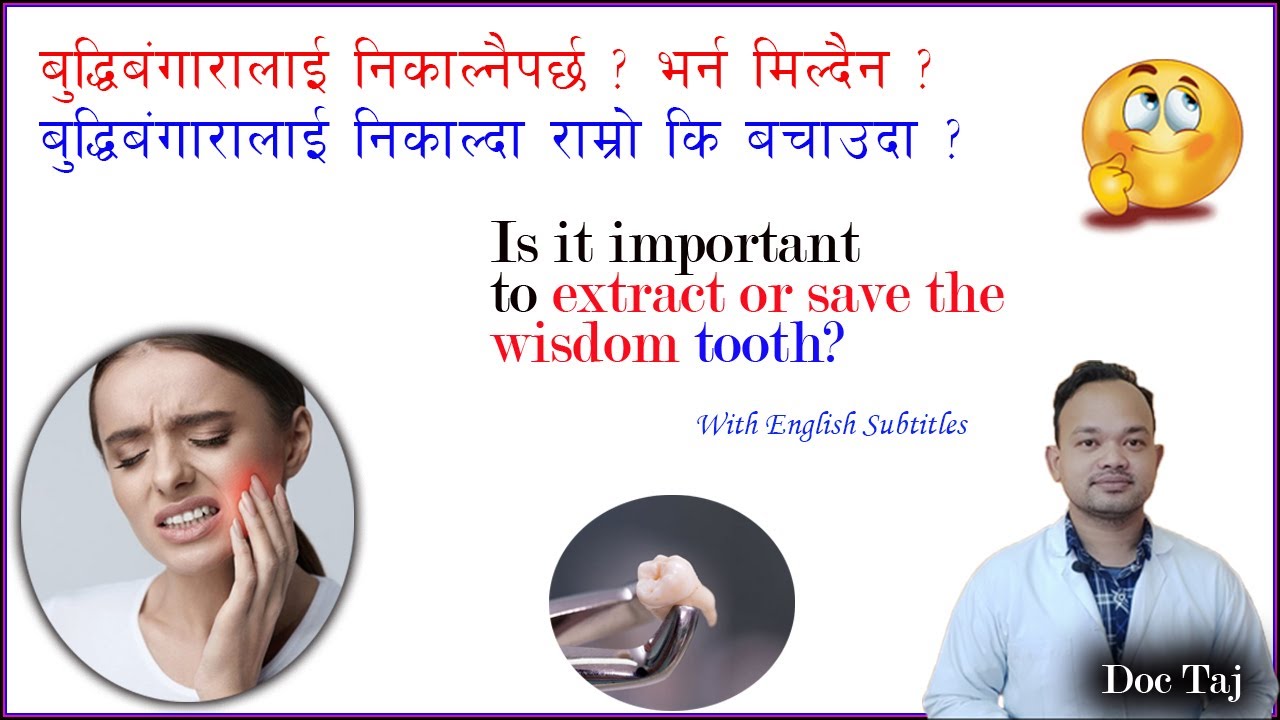 बुद्धिबङ्गारालाई निकाल्नैपर्छ ? भर्न मिल्दैन?/ Wisdom tooth/ Teeth filling/Doc Taj/ Dentist in Nepal