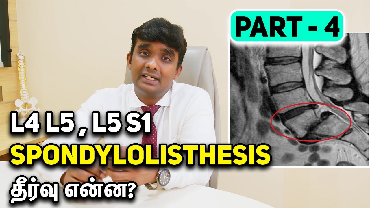 L4 L5 , L5 S1 Spondylolisthesis தீர்வு என்ன? with Dr. Vijayaraghavan | Spine Health Solutions Tamil